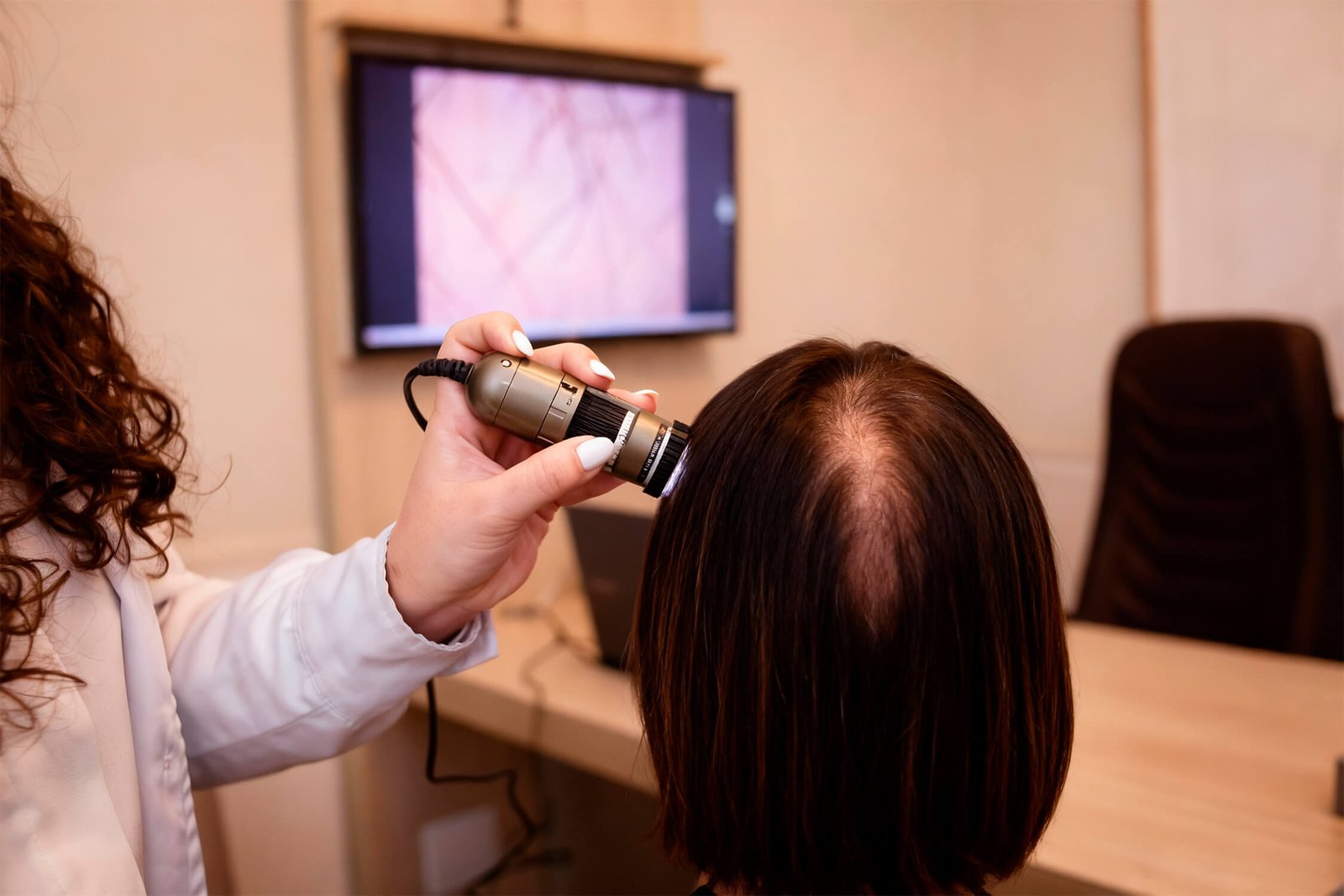 Por que meu shampoo antiqueda não funciona? A importância do Diagnóstico (Tricoscopia) em Barretos