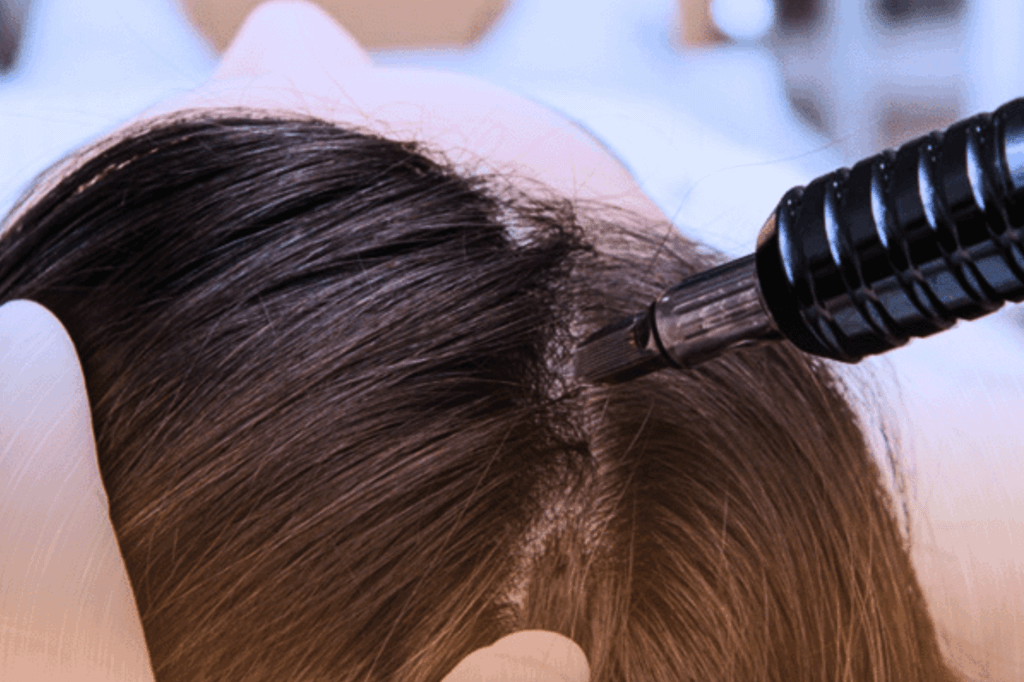 Bioestimulação Capilar: Como seu próprio organismo pode ajudar a frear a queda de cabelo